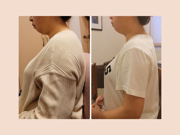 温熱筋膜リリース|makeroomPALETTE