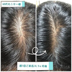 育毛ケアもお気軽にご相談ください！|Rias