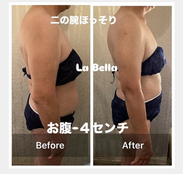 脂肪冷却①|エステサロン La Bella