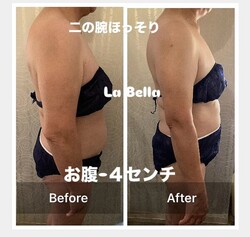 脂肪冷却①|エステサロン La Bella