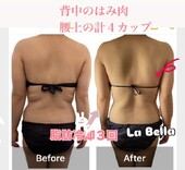 脂肪冷却③|エステサロン La Bella