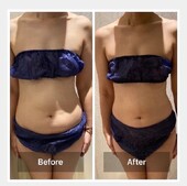 脂肪冷却④|エステサロン La Bella