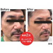 ホームケアをフルで使用|エステサロン La Bella