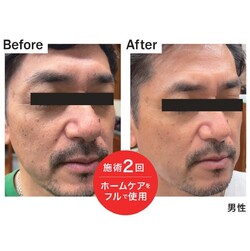 ホームケアをフルで使用|エステサロン La Bella