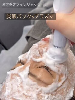 炭酸パック✕プラズマ|エステサロン Nanea