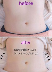 ウルトランスフォーマbefore/after①|la soie private salon