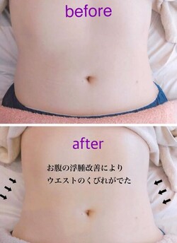 ウルトランスフォーマbefore/after①|la soie private salon