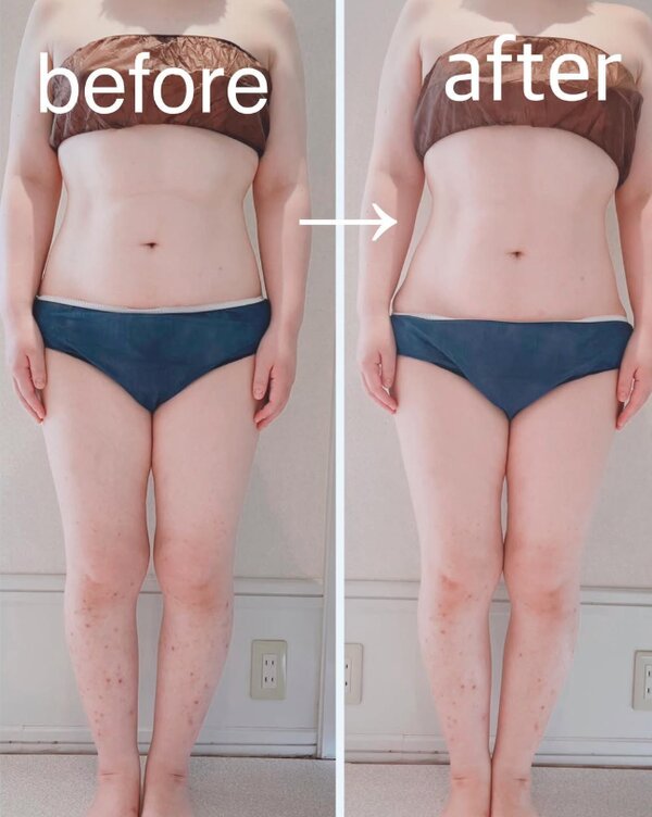 ウルトランスフォーマbefore/after②|la soie private salon