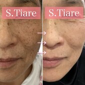 50代女性②|S.Tiare_NAGOYA