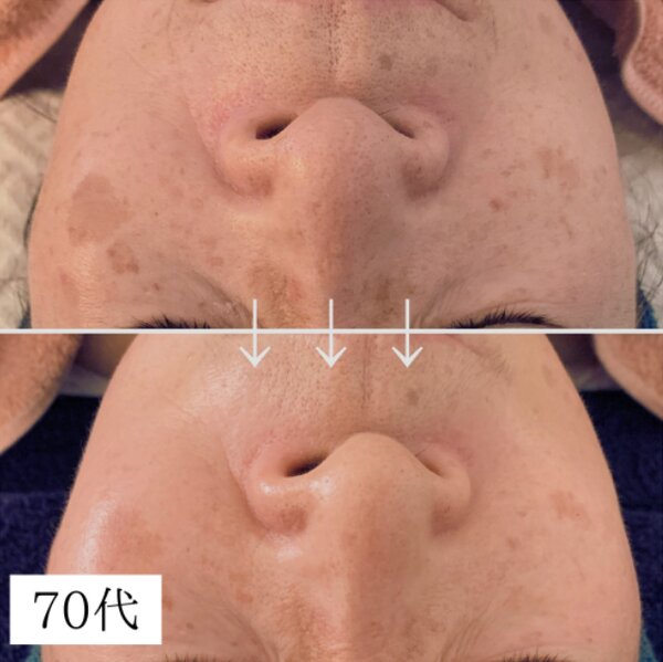 70代女性|S.Tiare_NAGOYA