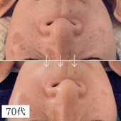 70代女性|S.Tiare_NAGOYA