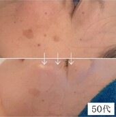 50代女性①|S.Tiare_NAGOYA