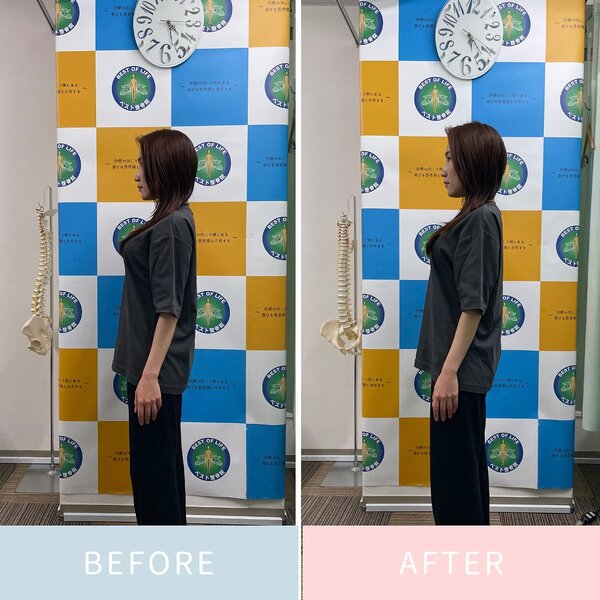 美容ソフト矯正のbefore&amp;after|ベスト整骨院