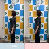 美容ソフト矯正のbefore&amp;after|ベスト整骨院