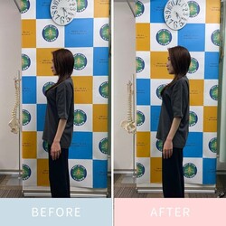 美容ソフト矯正のbefore&amp;after|ベスト整骨院