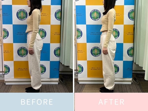 美容ソフト矯正のbefore&amp;after|ベスト整骨院