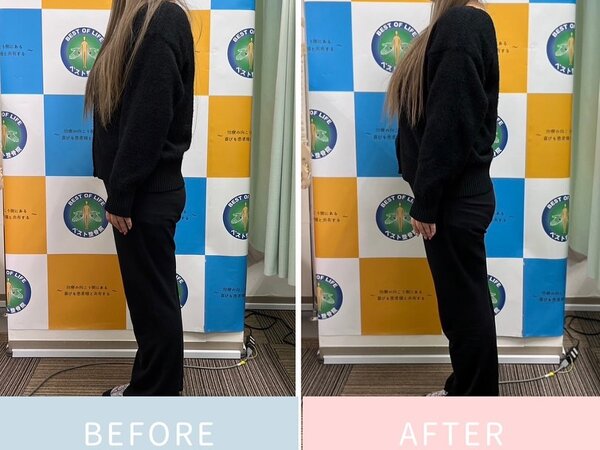 腰痛解消◎|ベスト整骨院