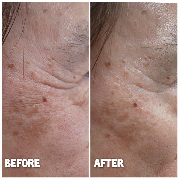 ヒト幹細胞フェイシャル|美と健康のサロン ナルミ