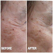 ヒト幹細胞フェイシャル|美と健康のサロン ナルミ