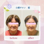 スッキリ小顔コース|小顔サロン藍