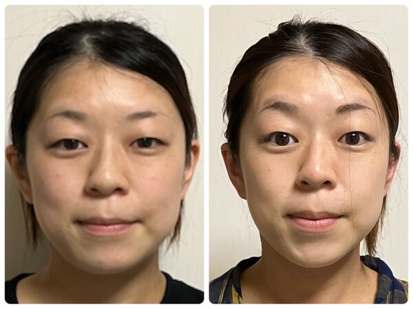 スッキリ小顔コース★|小顔サロン藍