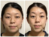 スッキリ小顔コース★|小顔サロン藍