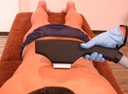 うなじ～背中の光脱毛|メンズ脱毛 LUSSO ROSSO