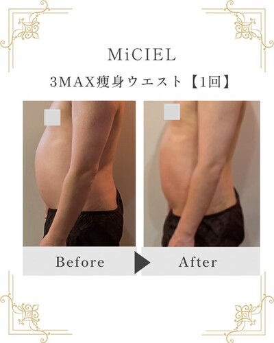 3MAX痩身ウエスト【1回】　