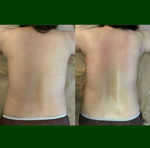 ハイパーナイフ全身90分ダイエットコース|オーガニックサロン flow