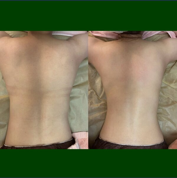 リリースカッター＋ハイパーナイフ 60分|オーガニックサロン flow