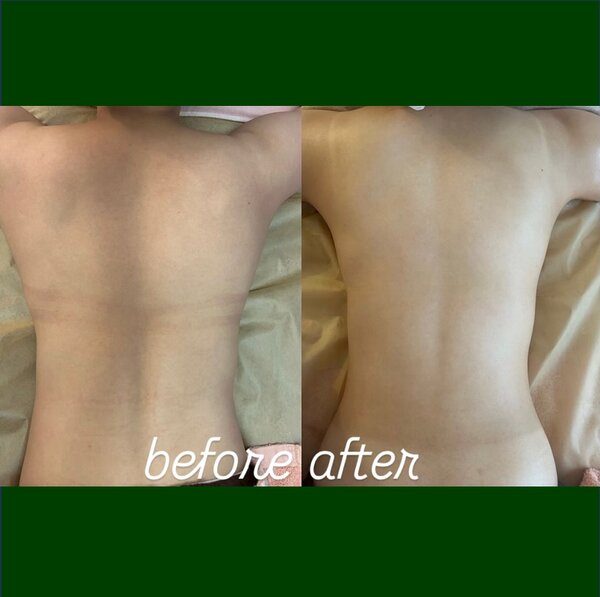 ブライダルエステ|オーガニックサロン flow