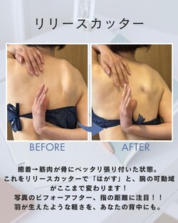 リリースカッターの施術が少し変わります！