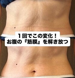 癒着による「もたつき」をリセット！