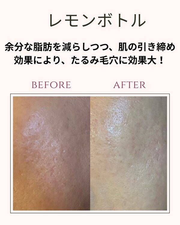 レモンボトルフェイシャル|オーガニックサロン flow