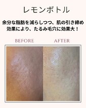 レモンボトルフェイシャル|オーガニックサロン flow
