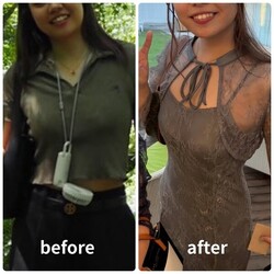 【Before＆After】おすすめは水素まみれコース