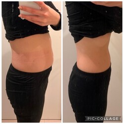 【Before＆After】食事制限なし！