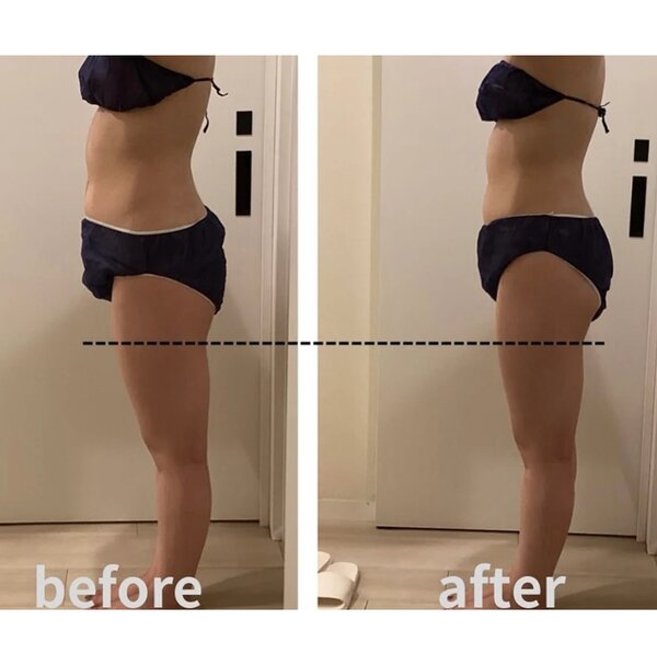 【Before＆After】内側から引き締める！|YOSAPARK RAVI千川【痩身/温活/体質改善】 板橋区