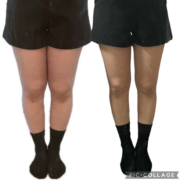 【Before＆After】浮腫撃退！|YOSAPARK RAVI千川【痩身/温活/体質改善】 板橋区