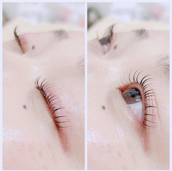 LUSHLIFTとフォトフェイシャル|Beauty salon Ivy