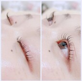 LUSHLIFTとフォトフェイシャル|Beauty salon Ivy