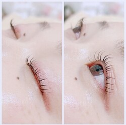 LUSHLIFTとフォトフェイシャル