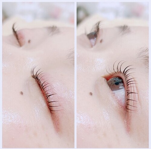LUSHLIFTとフォトフェイシャル