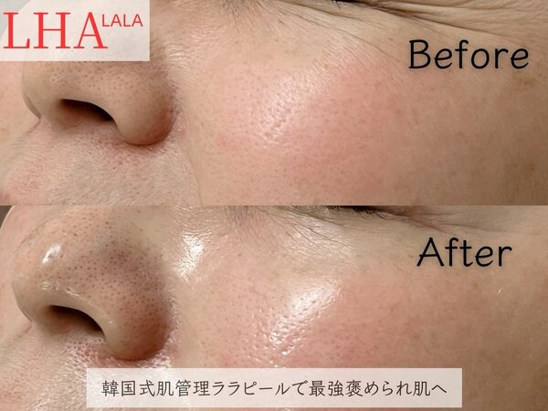 ララピール|Beauty salon Ivy