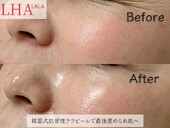 ララピール|Beauty salon Ivy
