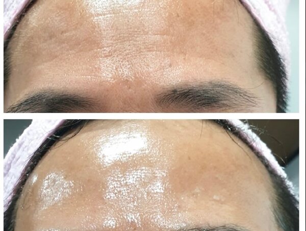 ララピール|Beauty salon Ivy