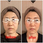 小顔かっさ|DIGNITA coco 自由が丘