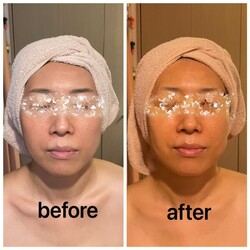 ☆before after③
