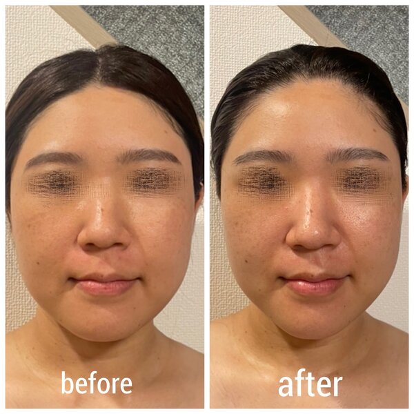 ☆before after②|DIGNITA coco 自由が丘