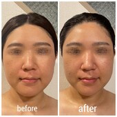 ☆before after②|DIGNITA coco 自由が丘